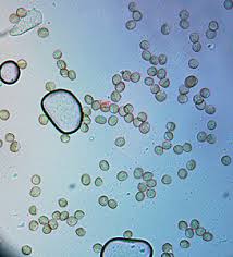 Attēlu rezultāti vaicājumam “Reticularia jurana young”