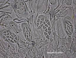 Attēlu rezultāti vaicājumam “Biatora sphaeroides”