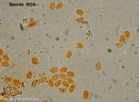 Attēlu rezultāti vaicājumam “Schizopora paradoxa”