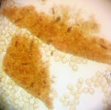 Attēlu rezultāti vaicājumam “Trichia longipalpis sessile”