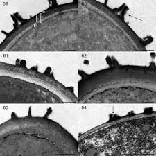 Attēlu rezultāti vaicājumam “Trichia scabra sessile”