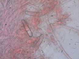 Attēlu rezultāti vaicājumam “Junghuhnia pseudozilingiana”