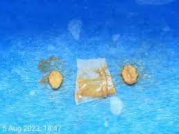 Attēlu rezultāti vaicājumam “Badhamia sp.”