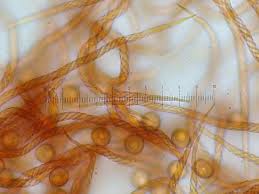 Attēlu rezultāti vaicājumam “Metatrichia floriformis”