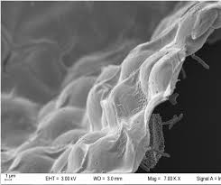 Attēlu rezultāti vaicājumam “Diachea subsessilis stalked”