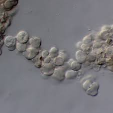 Attēlu rezultāti vaicājumam “Erythricium aurantiacum”