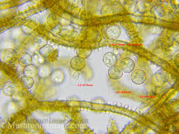 Attēlu rezultāti vaicājumam “Heterotrichia obvelata (syn. Arcyria obvelata) spores”