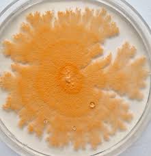Attēlu rezultāti vaicājumam “Trichia contorta spores”