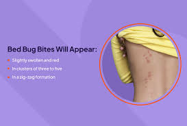 Image result for bed bug bites
