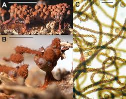 Attēlu rezultāti vaicājumam “Metatrichia vesparia spores”