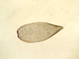 Attēlu rezultāti vaicājumam “Sphagnum magellanicum”