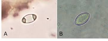 Attēlu rezultāti vaicājumam “Cribraria languescens spores”
