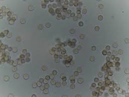 Attēlu rezultāti vaicājumam “Stemonitis marjana spores”