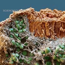 Attēlu rezultāti vaicājumam “Caloplaca saxicola”