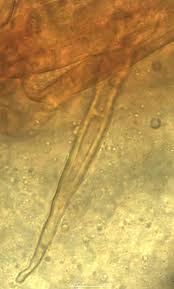 Attēlu rezultāti vaicājumam “Ophiostoma polyporicola”