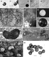 Attēlu rezultāti vaicājumam “Didymium annulisporum sessile”