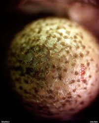 Attēlu rezultāti vaicājumam “Lycogala sphaeroconicum macro”