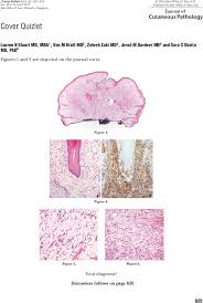 Attēlu rezultāti vaicājumam “Diderma chondrioderma sessile”