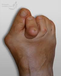 Znalezione obrazy dla zapytania palec