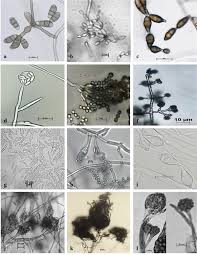 Attēlu rezultāti vaicājumam “Comatricha elegans var. microspora”