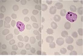Attēlu rezultāti vaicājumam “Enteridium variabile plasmodium”