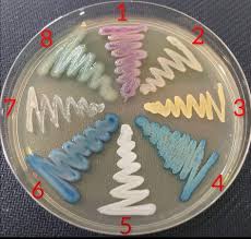 Attēlu rezultāti vaicājumam “Lycogala alisaulianovae young”