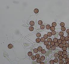 Attēlu rezultāti vaicājumam “Physarum obscurum spores”