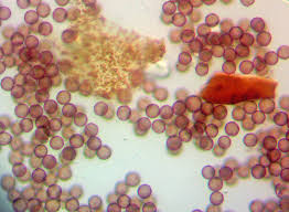 Attēlu rezultāti vaicājumam “Diderma deplanatum sessile”