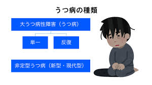 Image result for うつ病 亜型分類