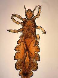 Attēlu rezultāti vaicājumam “Pediculus humanus capitis”