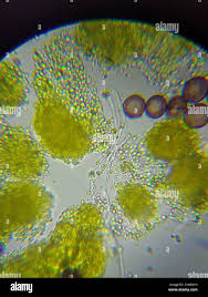 Attēlu rezultāti vaicājumam “Physarum viride var. aurantium spores”