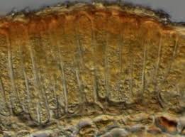 Attēlu rezultāti vaicājumam “Melampsora magnusiana”