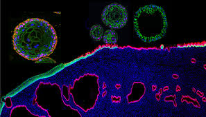 Attēlu rezultāti vaicājumam “Pseudobryum cinclidioides cells”