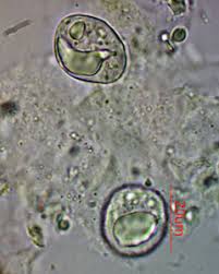 Attēlu rezultāti vaicājumam “Octospora splachnophila spores”