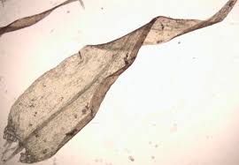 Attēlu rezultāti vaicājumam “Drepanocladus aduncus”