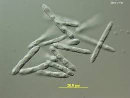 Attēlu rezultāti vaicājumam “Mycosphaerella millegrana”