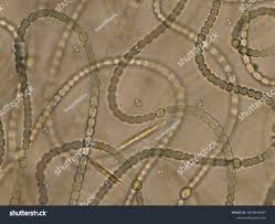 Attēlu rezultāti vaicājumam “Nostoc pruniforme”