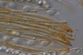 Attēlu rezultāti vaicājumam “Octospora humosa”