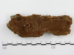 Attēlu rezultāti vaicājumam “Phellinus nigrolimitatus”