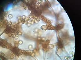 Attēlu rezultāti vaicājumam “Cribraria aurantiaca spores”