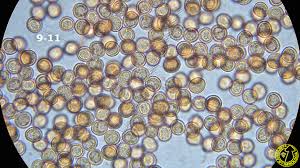 Attēlu rezultāti vaicājumam “Dictydiaethalium plumbeum spores”