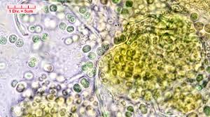 Attēlu rezultāti vaicājumam “Gloeocapsa rupestris”