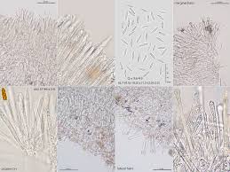 Attēlu rezultāti vaicājumam “Lachnum virgineum”