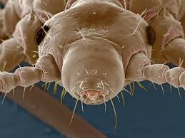 Attēlu rezultāti vaicājumam “Pediculus humanus capitis”