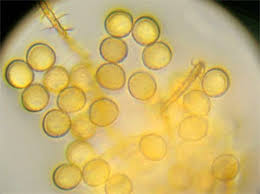 Attēlu rezultāti vaicājumam “Ophiotheca chrysosperma macro”