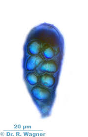 Attēlu rezultāti vaicājumam “Pleurosticta acetabulum”