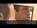 Face transplant for 'zombie' victim? First comes simple survival ...