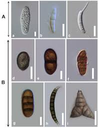 Attēlu rezultāti vaicājumam “Rosellinia desmazieri spores”