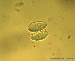 Attēlu rezultāti vaicājumam “Disciotis venosa”