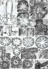 Attēlu rezultāti vaicājumam “Symphytocarpus impexus plasmodium”